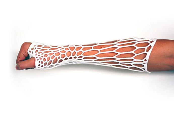 Protesi braccio stampata in 3D Voronoi